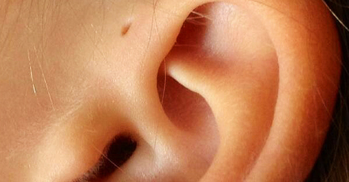 Seio pré-auricular: o que é e quem tem esse furinho na orelha?