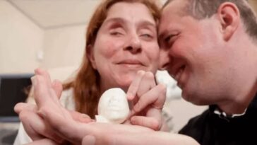 casal cego consegue sentir bebê por ultrassom 3D