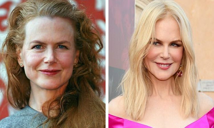 celebridades velhas nicole kidman