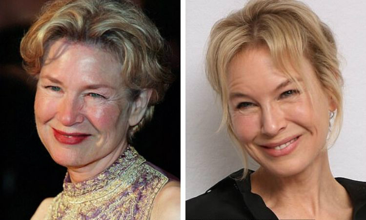 celebridades velhas renee zellweger