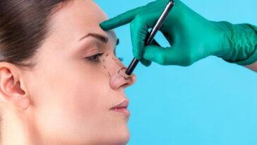 mudanças rinoplastia