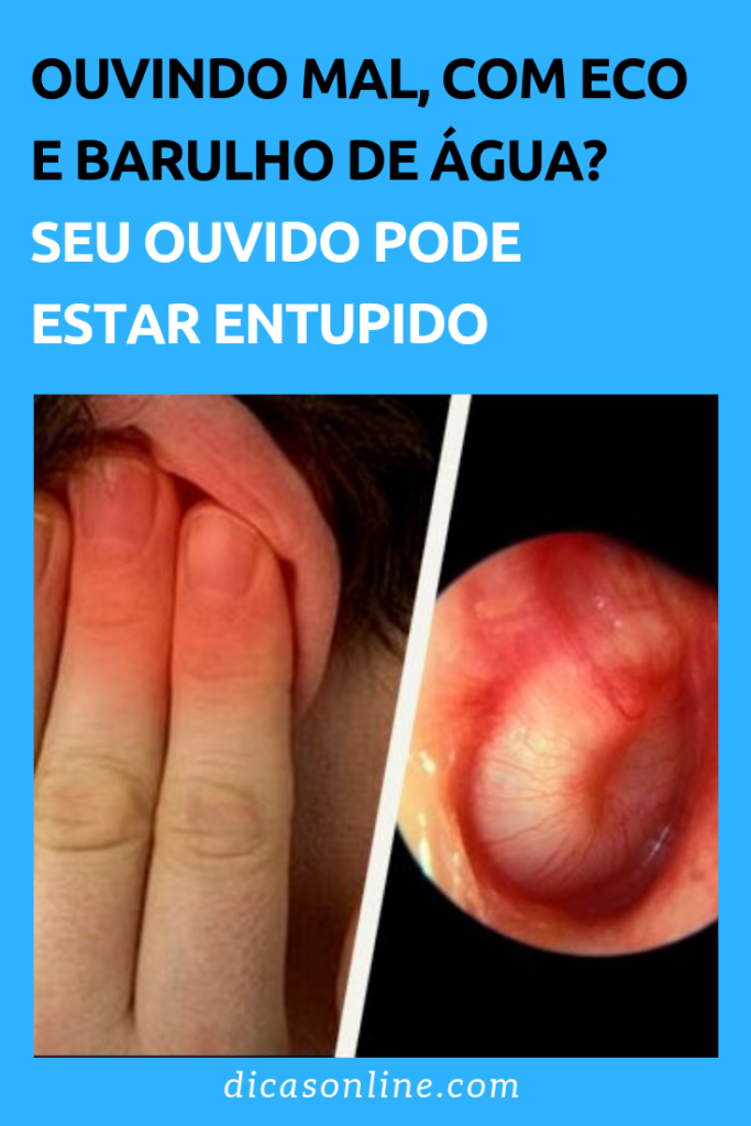 Como Desentupir O Ouvido