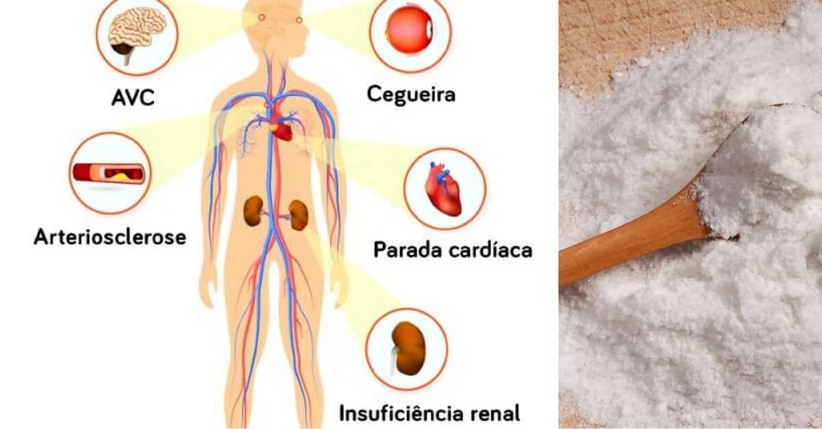 O Sódio Pode Representar Vários Perigos Para A Saúde 6754